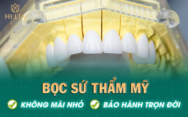 Bọc răng sứ không mài nhỏ chỉ có tại HELIA