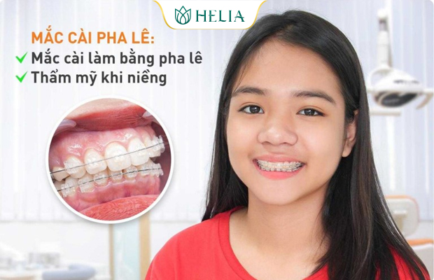 Trải nghiệm khách hàng khi niềng răng mắc cài pha lê tại HELIA