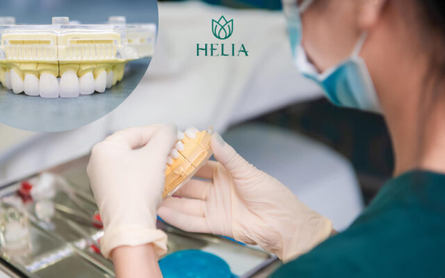 Bọc răng sứ Pico Zolid cao cấp Đức - Công nghệ bọc sứ được tín đồ làm đẹp ưa chuộng tại HELIA