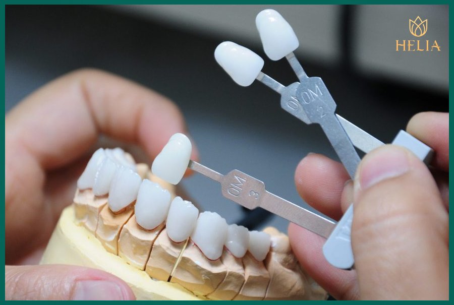 Thực hiện bọc sứ toàn hàm giúp bạn sở hữu nụ cười trắng đều tự nhiên