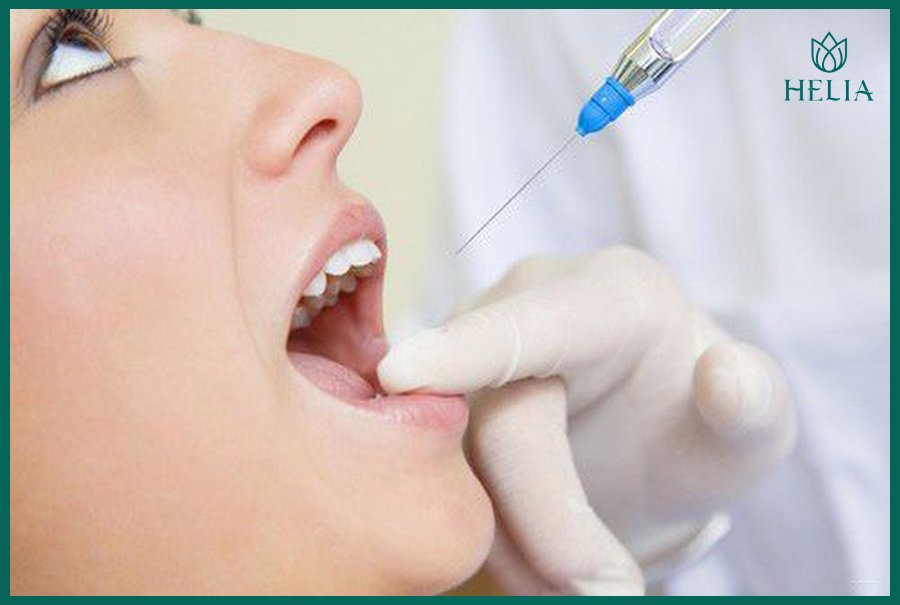 Gây tê & Mài răng